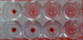 Complement fixation test (CFT)
