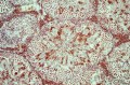 Your IHC results in 30 minutes